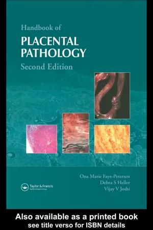 Handbook of Placental Pathology