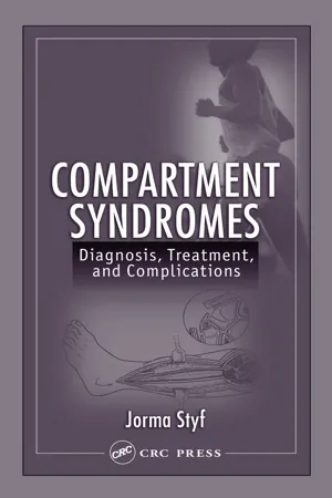 Compartment Syndromes