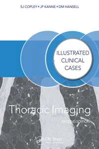 Thoracic Imaging_cover