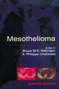 Mesothelioma_cover