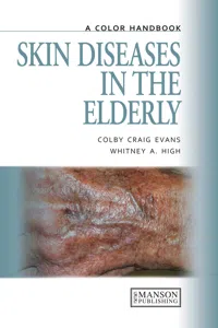 Skin Diseases in the Elderly_cover