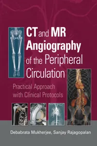 CT and MR Angiography of the Peripheral Circulation_cover