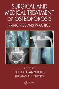 Surgical and Medical Treatment of Osteoporosis_cover
