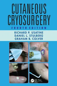 Cutaneous Cryosurgery_cover