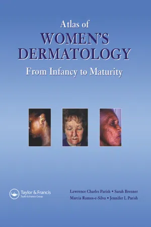 Atlas of Women's Dermatology