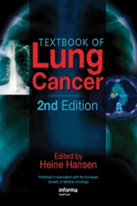 Textbook of Lung Cancer_cover