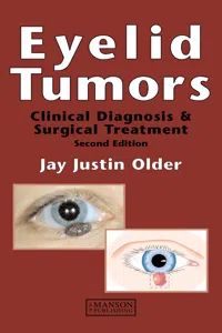 Eyelid Tumors_cover