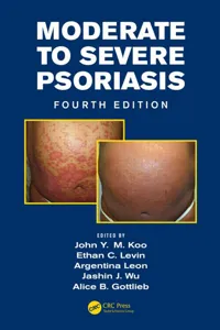 Mild to Moderate and Moderate to Severe Psoriasis_cover