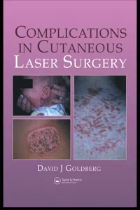 Complications in Laser Cutaneous Surgery_cover