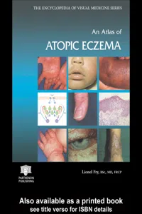 An Atlas of Atopic Eczema_cover