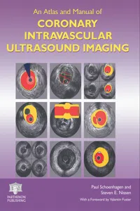 An Atlas and Manual of Coronary Intravascular Ultrasound Imaging_cover