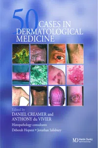Fifty Dermatological Cases_cover