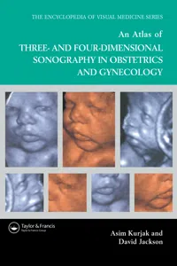 An Atlas of Three- and Four-Dimensional Sonography in Obstetrics and Gynecology_cover