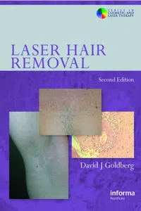Laser Hair Removal_cover