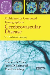 Multidetector Computed Tomography in Cerebrovascular Disease_cover