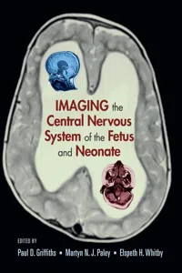 Imaging the Central Nervous System of the Fetus and Neonate_cover