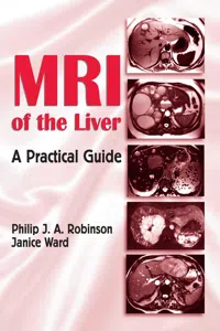MRI of the Liver_cover