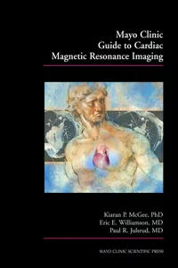 Mayo Clinic Guide to Cardiac Magnetic Resonance Imaging_cover