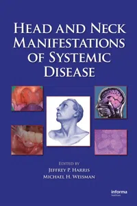 Head and Neck Manifestations of Systemic Disease_cover