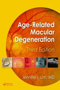 Age-Related Macular Degeneration, Third Edition_cover