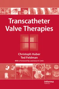 Transcatheter Valve Therapies_cover