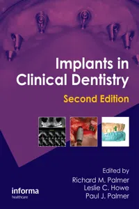 Implants in Clinical Dentistry_cover