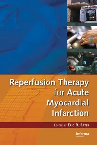 Reperfusion Therapy for Acute Myocardial Infarction_cover