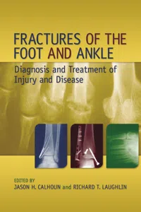 Fractures of the Foot and Ankle_cover