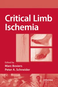 Critical Limb Ischemia_cover