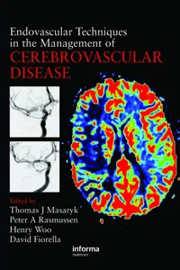 Endovascular Techniques in the Management of Cerebrovascular Disease_cover