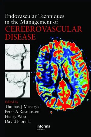 Endovascular Techniques in the Management of Cerebrovascular Disease