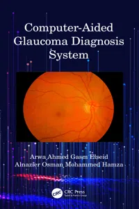 Computer-Aided Glaucoma Diagnosis System_cover