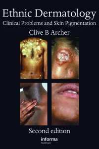 Ethnic Dermatology_cover