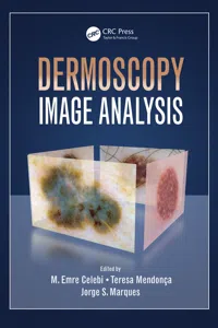 Dermoscopy Image Analysis_cover