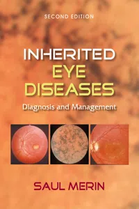 Inherited Eye Diseases_cover