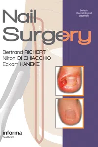 Nail Surgery_cover