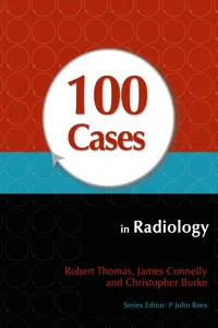 100 Cases in Radiology_cover
