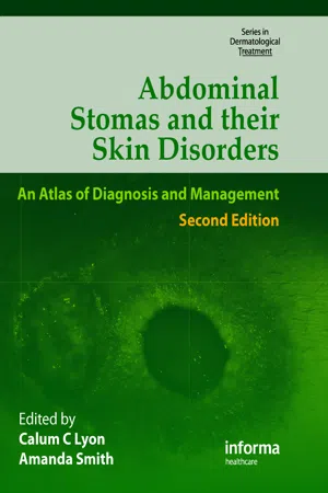 Abdominal Stomas and Their Skin Disorders