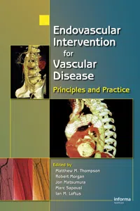 Endovascular Intervention for Vascular Disease_cover