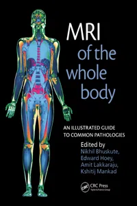 MRI of the Whole Body_cover