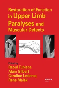 Restoration of Function in Upper Limb Paralyses and Muscular Defects_cover