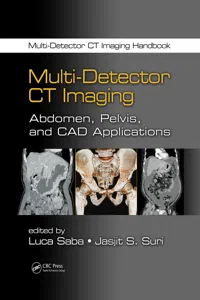 Multi-Detector CT Imaging_cover