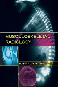 Musculoskeletal Radiology_cover