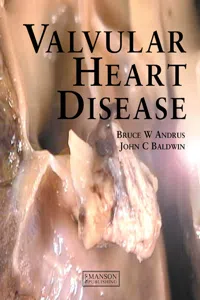 Valvular Heart Disease_cover