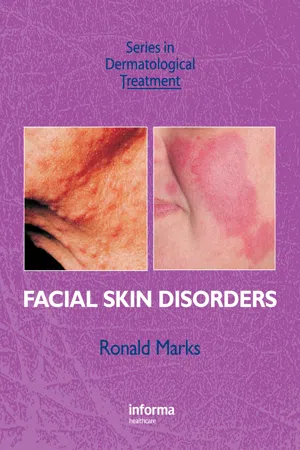 Facial Skin Disorders