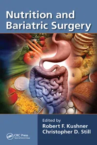 Nutrition and Bariatric Surgery_cover