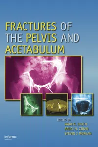 Fractures of the Pelvis and Acetabulum_cover