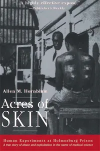 Acres of Skin_cover