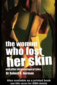 The Woman Who Lost Her Skin_cover