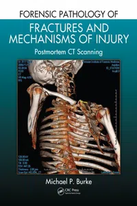 Forensic Pathology of Fractures and Mechanisms of Injury_cover